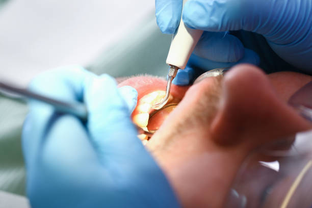 Best Emergency Dental Care for Abscessed Tooth in Dumbarton, VA