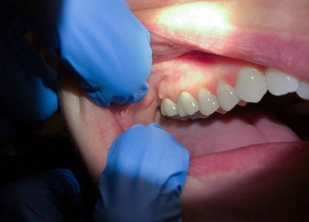 Best Weekend Emergency Dentist in Dumbarton, VA